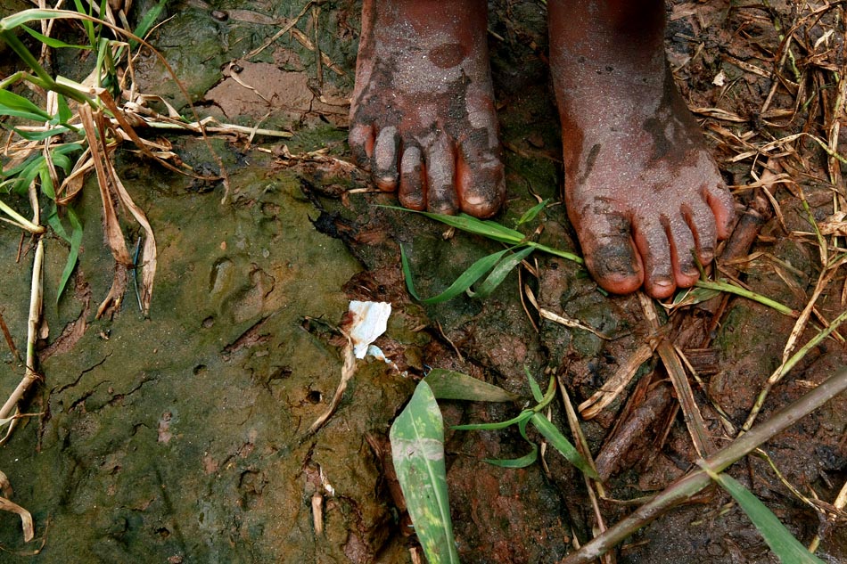 Detalhes dos pés do garoto Nathan Souza da Silva, de 5 anos, no dia de Natal. 25/01/2010. FOTO: VALÉRIA GONÇALVEZ/AE
